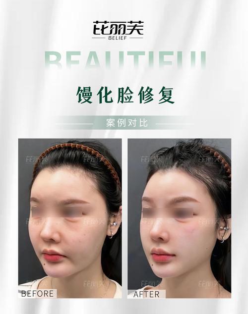 手机拍照脸模糊怎么修复？软件推荐有吗？